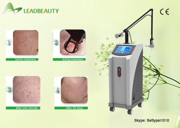 Buy cheap 2016 new products fractional co2 laser skin resurfacing machine from china from wholesalers