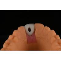 Buy cheap Roughened Surface Titanium Dental Implants Surgery For Front Tooth Replacement product