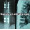 Buy cheap High Density Medical X Ray Film Blue For Konida Laser Printer from wholesalers