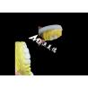 Buy cheap Custom Zirconia Dental Crown Precise Fit Tooth Cap from China dental lab from wholesalers
