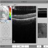 Buy cheap TUV Optical Coherence Tomography Scanner Spectral Domain Machine from wholesalers
