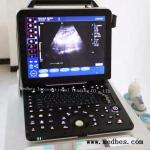 4D Portable Echocardiography Machine 4D Echo Color Digital Portable Ultrasound