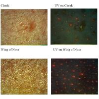 Buy cheap Facial Uv Skin Analyzer Machine For Skin Mositure / Grease / Wrinkle / product