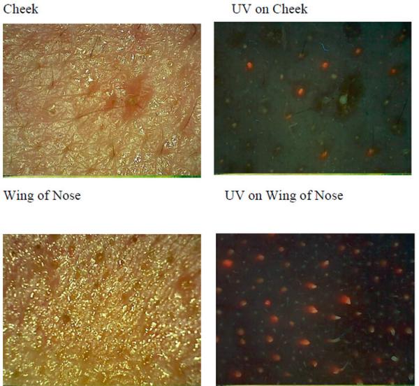 Buy cheap Facial Uv Skin Analyzer Machine For Skin Mositure / Grease / Wrinkle / Pigmentation from wholesalers
