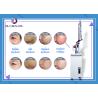 Buy cheap Q- Switch ND YAG Laser Machine Color Tattoo Removal 1064nm 532nm from wholesalers