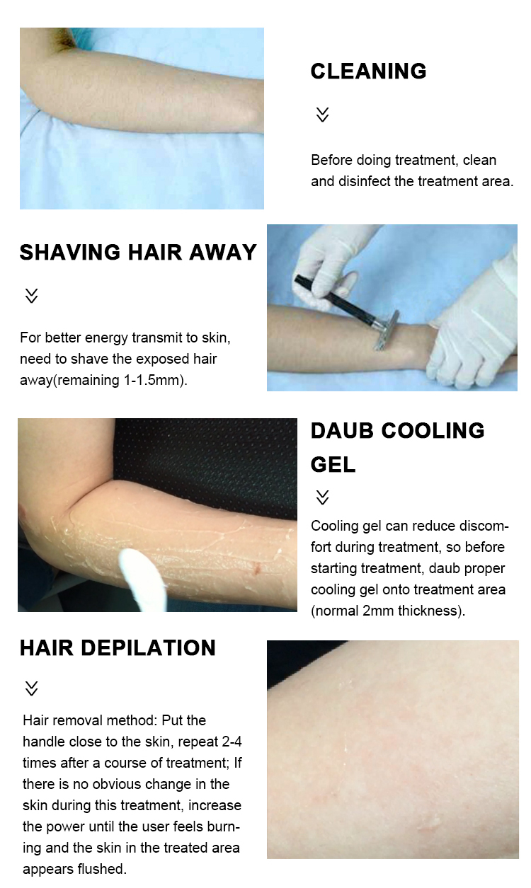 480nm 640nm Diode IPL Hair Removal Laser Machine Medical