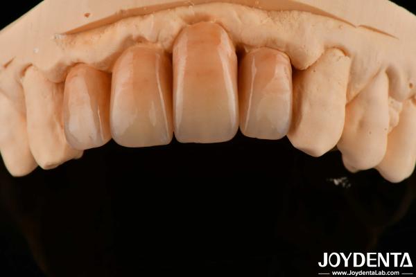 Buy cheap Polished Layered Zirconia White And Durable For Perfect Surface Finish from wholesalers