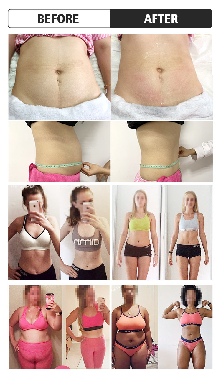 Laser Body Fat Melting Machine Slimming Electromagnetic Therapy Machine
