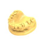 Precision Light Cure Resin Radiopaque Dental Resin For 3d Printing