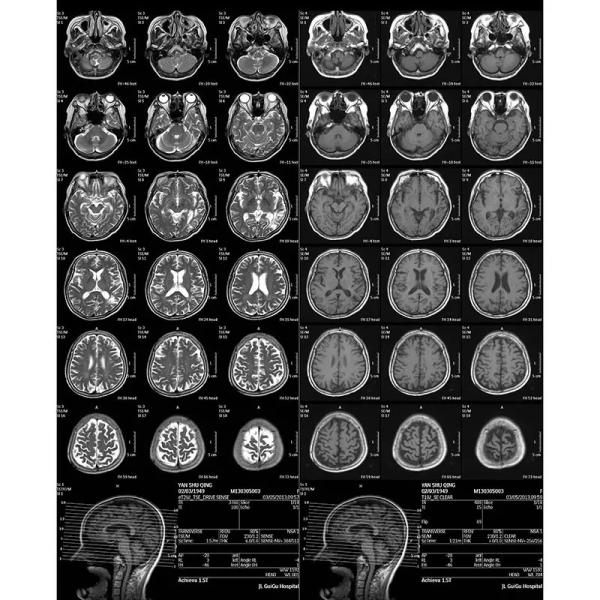 Buy cheap Automatic Density Adjusted Single Use Medical X Ray Film from wholesalers