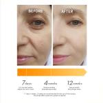 50G Vitamin C Moisturizer Facial Cream Natural Organic Vegan Anti Wrinkle