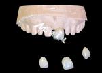 Custom Zirconia Dental Crown Precise Fit Tooth Cap from China dental lab