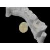 Buy cheap Accurate Fit Dental Ceramic Inlays Onlays , Porcelain Inlays And Onlays FDA Approved from wholesalers