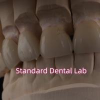 Buy cheap Professional Dental Lab Zirconia Crown For Fixed Restoration product