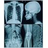 Buy cheap 25cm X 30cm Blue Transparency PET Thermal Film Medical Dry Imaging Film For Hospital from wholesalers