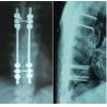 Buy cheap Waterproof Medical Xray Paper PET , Film For Konida Laser Printer，radiographic paper film from wholesalers