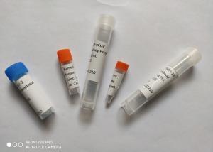 Wholesale Recombinant 2019-NCoV Mouse Monoclonal Antibody Spike RBD Protein from china suppliers