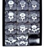 White PET AGFA Medical Dry Film