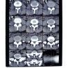 Buy cheap 8in * 10in Medical Dry Transparency PET paper Film from wholesalers