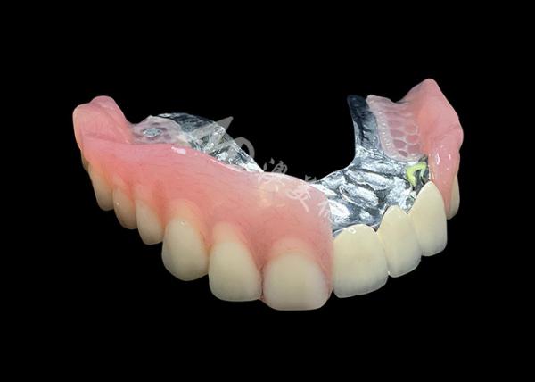 Buy cheap Enhance Your Smile Natural-looking PFM Crown bridge and Removable Dentures Combo from wholesalers