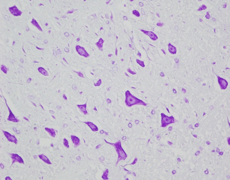 Nissl Body Stain Cresyl Violet Acetate Method Clear Colourful Histology Stains