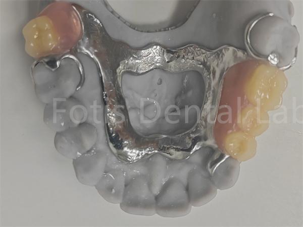 Buy cheap FDA Easy To Clean Removable Partial Denture Compatible With Natural Teeth from wholesalers