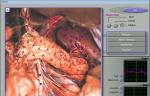 3d Nls Health Body Composition Analyzer , Blood Cell Analyzer