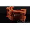 Buy cheap Post Core Dental Lab from China / Metal Post Core with PFM Crown from wholesalers