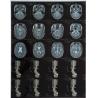Buy cheap Laser Film for Medical X-ray Image Output Printing from wholesalers