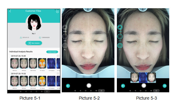 Beauty Salon Facial Skin Analyzer 15/18/20 Mega Pixels Camera With Tablet