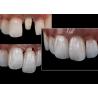 Buy cheap All Ceramic Crowns and Bridges Designed for Superior Aesthetics Durability and Natural Fit for Long-Lasting Confidence from wholesalers