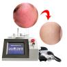 Buy cheap 6 In 1 Spider Vein Laser Machine , 980nm Face Vascular Treatment Varicose Veins Machine from wholesalers