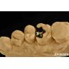 Buy cheap Clinical Metallic Dental Gold Crown 60K Gold Tooth Cap For Oral Rehabilitation from wholesalers