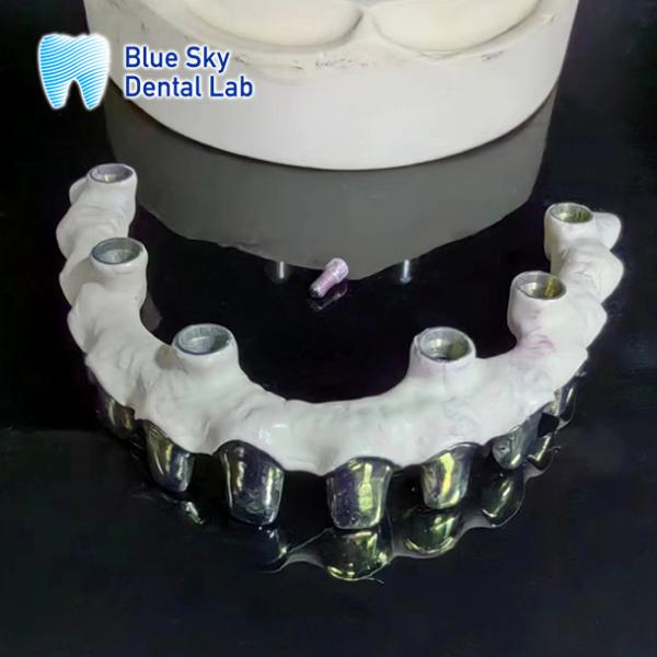 Buy cheap Pure Titanium Malo Bridge Customizable Silver Metal Frame Teeth from wholesalers