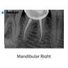 Buy cheap Waterproof 22.2*29.6mm 16lp/Mm 19um Dental X Ray Machine from wholesalers