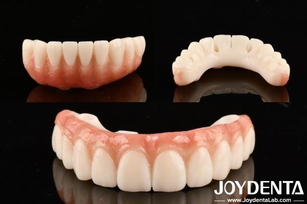 High Transparency Dental PMMA M75 For Aesthetic And Scratch Resistant Restoratio