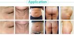 2018 Effective five handles mini cavitation rf vacuum professional slimming