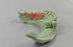 Experience the Benefits of Invisible Resin for Lightweight and Affordable