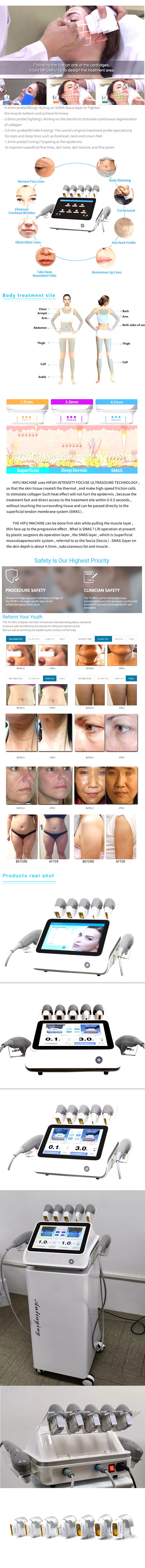 RF Non Invasive Body Contouring Machine , Anti Puffiness HIFU Korea Machine