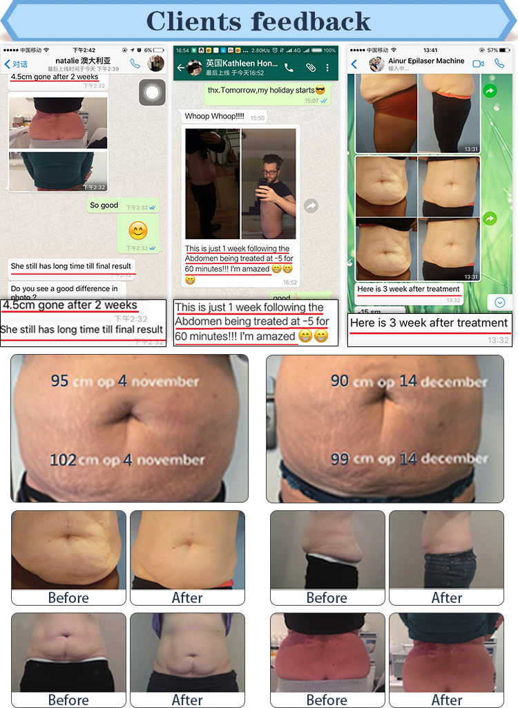 cryolipolysis slimming machine ICE SHAPING IV PRO