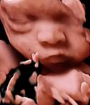 3D 4D 5D Color Doppler Ultrasound Trolley Ultrasound Scanner For OB GYN