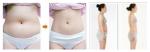 2018 trending products 4 handles laser weight loss machine ultra cavitation