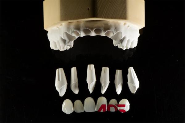 Buy cheap Dental Porcelain Feldspathic Veneers For Teeth Custom Shaped from wholesalers
