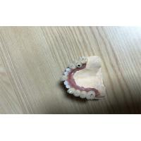 Buy cheap Accurate Biocompatibility Dental Implant Attachments Tooth Implant Crown product