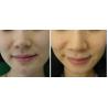 Buy cheap radio frequency microneedle rf skin tightening beauty machine from wholesalers