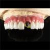 Buy cheap Fixed Restorations Full Arch Zirconia Implant Bridge Denture Teeth from wholesalers