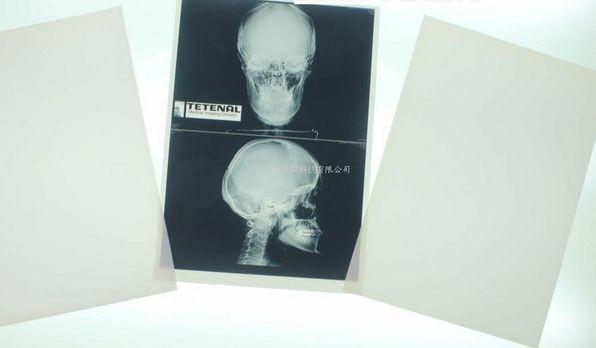Buy cheap 11 x 14 Laser Medical Diagnostic Imaging For Konida Laser Printer from wholesalers