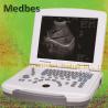 Buy cheap Professional Ultrasound Imaging System 15 Inch LED Laptop Hospital Machine from wholesalers