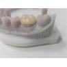 Buy cheap OEM Dental Inlay And Onlay Ceramic Restoration And Tooth-Colored Filling from wholesalers