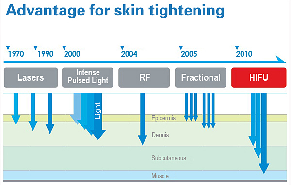 Best Anti-Aging High Intensity Focused Ultrasound Hifu Wrinkle Removal